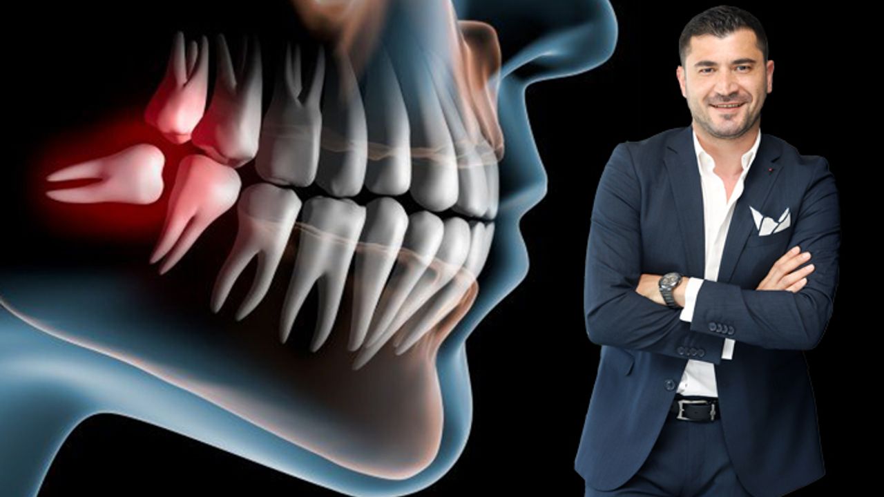 Dr.Dt. Sancar Şimşek anlattı: Gömülü Diş Tedavisi ve Gömülü Diş Çekimi